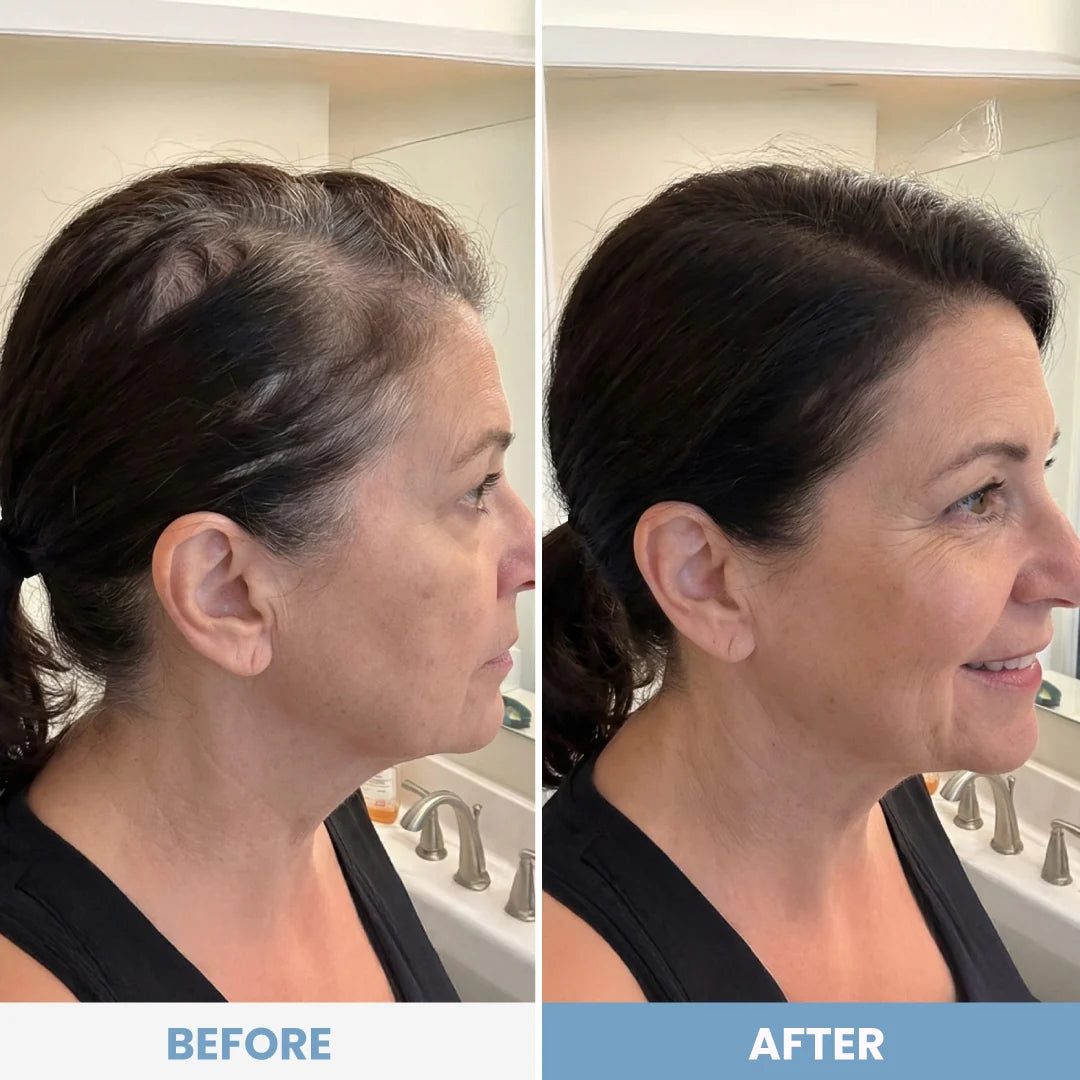 Why choose this hairline solution?