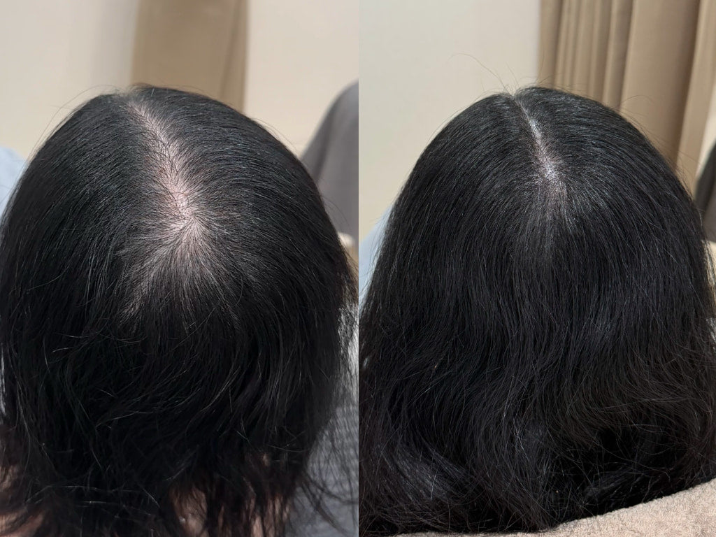 HairlineSafe Instand Touch-Up